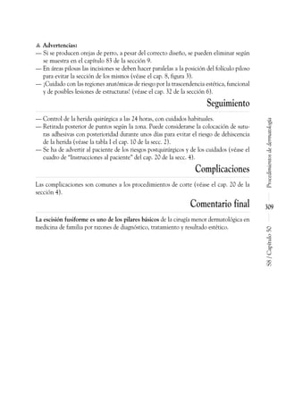 ▲ Advertencias:
–– Si se producen orejas de perro, a pesar del correcto diseño, se pueden eliminar según
se muestra en el capítulo 83 de la sección 9.
–– En áreas pilosas las incisiones se deben hacer paralelas a la posición del folículo piloso
para evitar la sección de los mismos (véase el cap. 8, figura 3).
–– ¡Cuidado con las regiones anatómicas de riesgo por la trascendencia estética, funcional
y de posibles lesiones de estructuras! (véase el cap. 32 de la sección 6).
Seguimiento
–– Control de la herida quirúrgica a las 24 horas, con cuidados habituales.
–– Retirada posterior de puntos según la zona. Puede considerarse la colocación de sutu-
ras adhesivas con posterioridad durante unos días para evitar el riesgo de dehiscencia
de la herida (véase la tabla I el cap. 10 de la secc. 2).
–– Se ha de advertir al paciente de los riesgos postquirúrgicos y de los cuidados (véase el
cuadro de “Instrucciones al paciente” del cap. 20 de la secc. 4).
Complicaciones
Las complicaciones son comunes a los procedimientos de corte (véase el cap. 20 de la
sección 4).
Comentario final
La escisión fusiforme es uno de los pilares básicos de la cirugía menor dermatológica en
medicina de familia por razones de diagnóstico, tratamiento y resultado estético.
Procedimientos
de
dermatología
S8
/
Capítulo
50
309
 