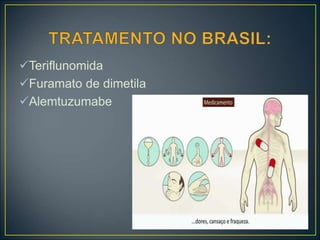 Teriflunomida
Furamato de dimetila
Alemtuzumabe
 