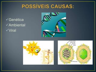 Genética
Ambiental
Viral
 