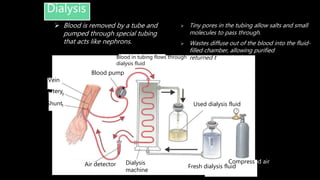  Tiny pores in the tubing allow salts and small
molecules to pass through.
 Wastes diffuse out of the blood into the fluid-
filled chamber, allowing purified blood to be
returned to the body.
Dialysis
Air detector Dialysis
machine
Fresh dialysis fluid
Compressed air
Vein
Artery
Shunt
Blood pump
Blood in tubing flows through
dialysis fluid
Used dialysis fluid
 Blood is removed by a tube and
pumped through special tubing
that acts like nephrons.
 