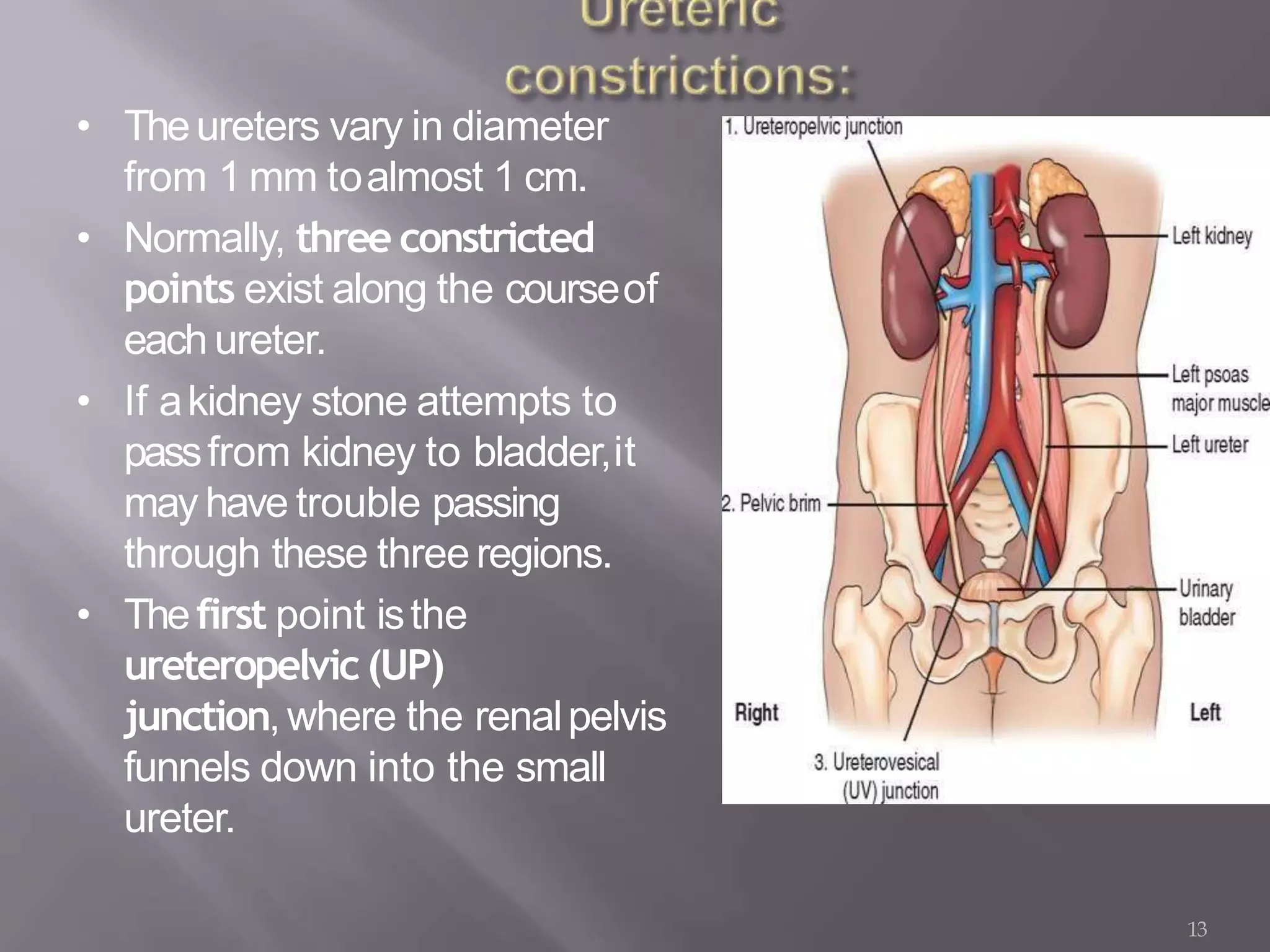 13
• Theureters vary in diameter
from 1 mm toalmost 1 cm.
• Normally, three constricted
points exist along the courseof
each ureter.
• If akidney stone attempts to
passfrom kidney to bladder,it
may have trouble passing
through these threeregions.
• Thefirst point isthe
ureteropelvic(UP)
junction,where the renalpelvis
funnels down into the small
ureter.
 