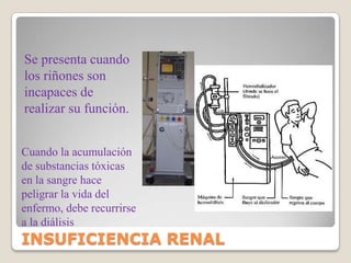 sangreCélulasproteínasFILTRACIÓN GLOMERULAR
