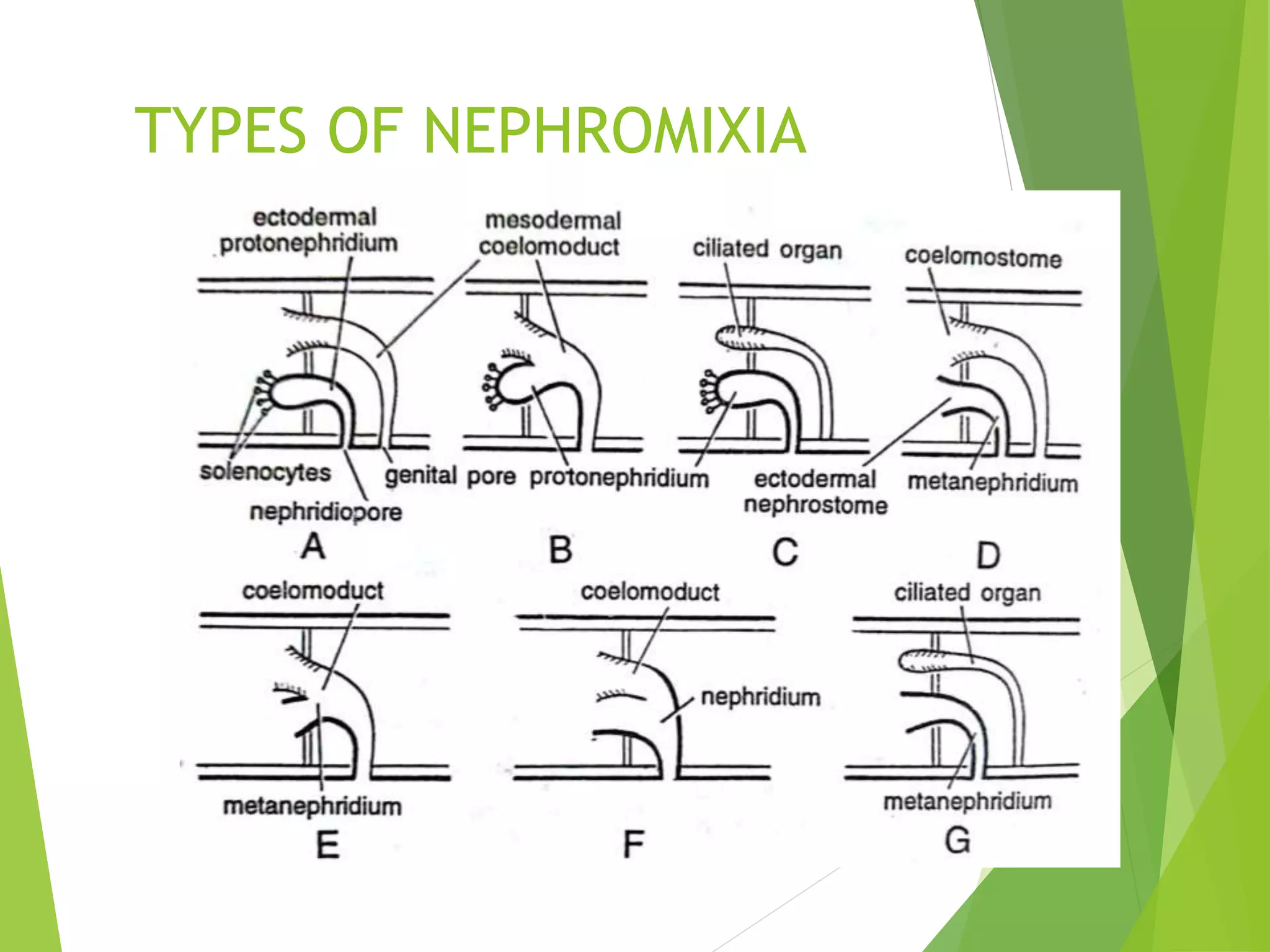 TYPES OF NEPHROMIXIA
 