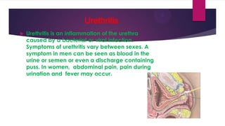 Urethritis


Urethritis is an inflammation of the urethra
caused by a bacterial or viral infection.
Symptoms of urethritis vary between sexes. A
symptom in men can be seen as blood in the
urine or semen or even a discharge containing
puss. In women, abdominal pain, pain during
urination and fever may occur.

 