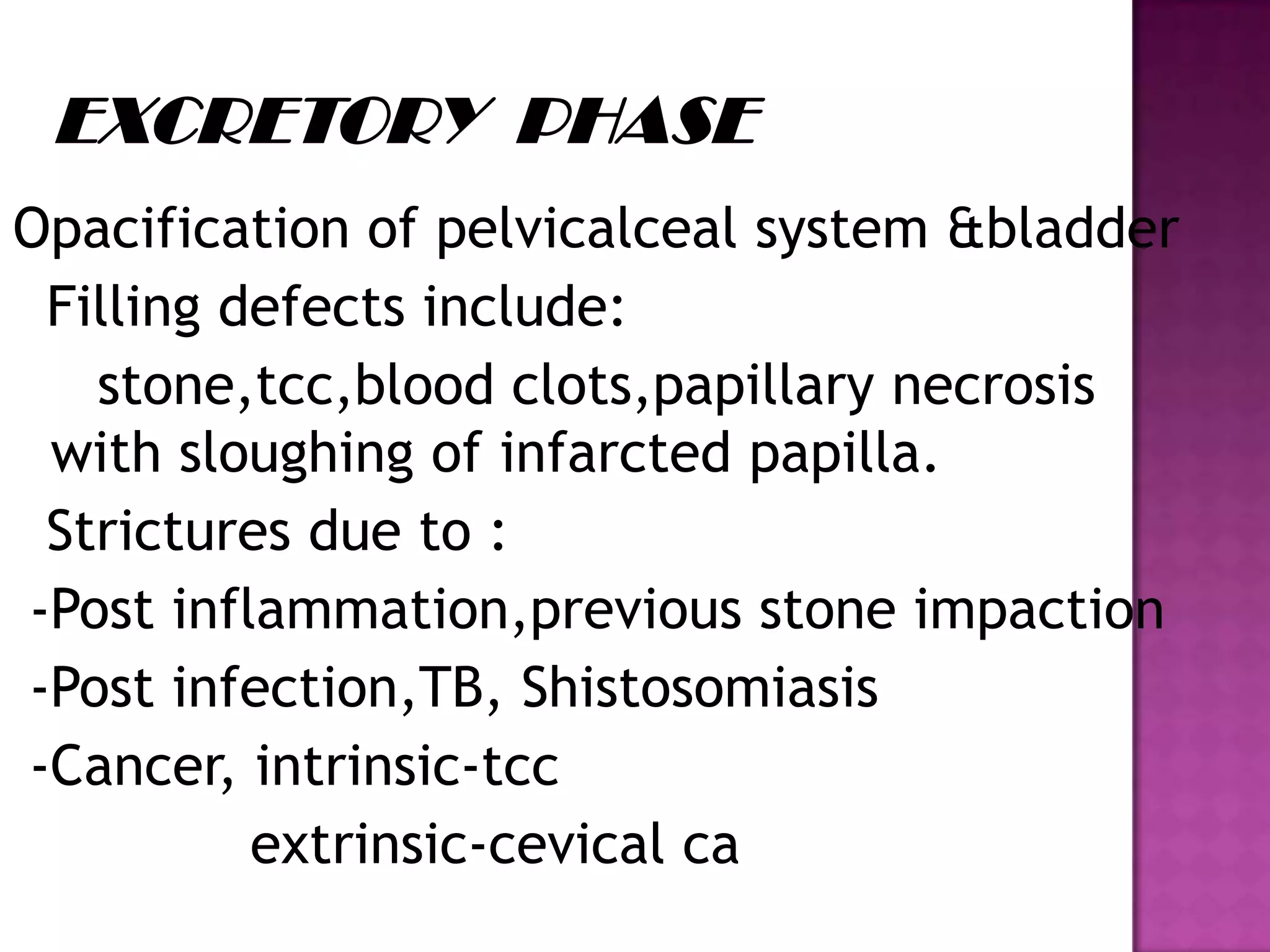 Opacification of pelvicalceal system &bladder
Filling defects include:
stone,tcc,blood clots,papillary necrosis
with sloughing of infarcted papilla.
Strictures due to :
-Post inflammation,previous stone impaction
-Post infection,TB, Shistosomiasis
-Cancer, intrinsic-tcc
extrinsic-cevical ca
 