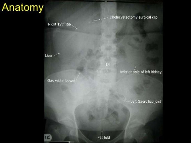 Excretory urography