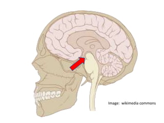 Image: wikimedia commons 
 