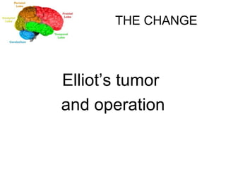 THE CHANGE Elliot’s tumor  and operation 