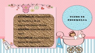 Focomelia Rx EVALUACION CLINICA PACIENTE CON DISCAPACIDAD INFANTIL | PPTX