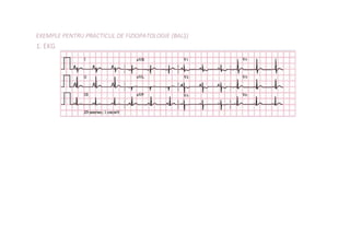 EXEMPLE PENTRU PRACTICUL DE FIZIOPATOLOGIE (BALȘ)
1. EKG
 