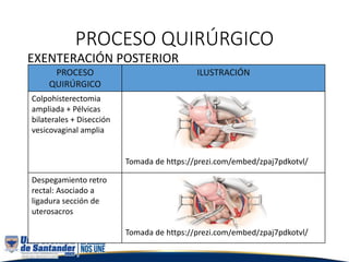 PROCESO QUIRÚRGICO
EXENTERACIÓN POSTERIOR
PROCESO
QUIRÚRGICO
ILUSTRACIÓN
Colpohisterectomia
ampliada + Pélvicas
bilaterales + Disección
vesicovaginal amplia
Tomada de https://prezi.com/embed/zpaj7pdkotvl/
Despegamiento retro
rectal: Asociado a
ligadura sección de
uterosacros
Tomada de https://prezi.com/embed/zpaj7pdkotvl/
 