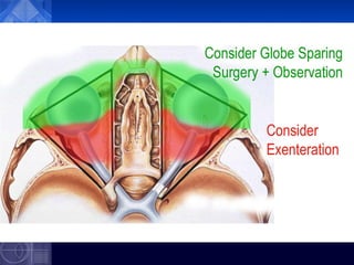 Exenterate Exenteration of the Orbit - orbital surgery | PPT
