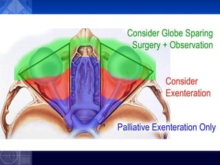 Exenteration of the Orbit - orbital surgery | PPT