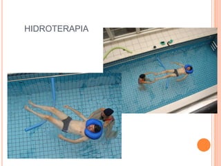 HIDROTERAPIA
 