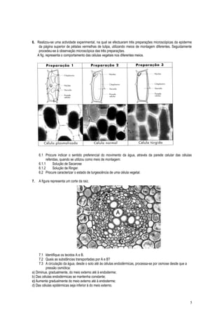 6. Realizou-se uma actividade experimental, na qual se efectuaram três preparações microscópicas da epiderme
da página superior de pétalas vermelhas de tulipa, utilizando meios de montagem diferentes. Seguidamente
procedeu-se à observação microscópica das três preparações.
A fig. representa o comportamento das células vegetais nos diferentes meios.
6.1 Procure indicar o sentido preferencial do movimento da água, através da parede celular das células
referidas, quando se utilizou como meio de montagem:
6.1.1 Solução de Sacarose
6.1.2 Solução de Ringer.
6.2 Procure caracterizar o estado de turgescência de uma célula vegetal.
7. A figura representa um corte da raiz.
7.1 Identifique os tecidos A e B.
7.2 Quais as substâncias transportadas por A e B?
7.3 A circulação da água, desde o solo até às células endodérmicas, processa-se por osmose desde que a
pressão osmótica:
a) Diminua, gradualmente, do meio externo até à endoderme;
b) Das células endodérmicas se mantenha constante;
c) Aumente gradualmente do meio externo até à endoderme;
d) Das células epidérmicas seja inferior à do meio externo.
5
 