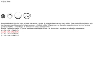 14. (Ueg 2006)
A membrana celular funciona como um fluido que permite a difusão de proteínas dentro de uma matriz lipídica. Esse mosaico fluido constitui uma
barreira de permeabilidade seletiva indispensável para a fisiologia celular. A figura mostra as alterações que podem ocorrer em uma hemácia
quando se modifica a concentração de NaCℓ no meio em que ela se encontra.
Assinale a afirmativa CORRETA para as diferentes concentrações de NaCℓ de acordo com a sequência da morfologia das hemácias:
a) 0,6%, 0,9%, 1,5% e 2,0%
b) 2,0%, 1,5%, 0,9% e 0,6%
c) 2,0%, 1,5%, 0,6% e 0,0%
d) 1,5%, 0,9%, 0,6% e 0,0%
 