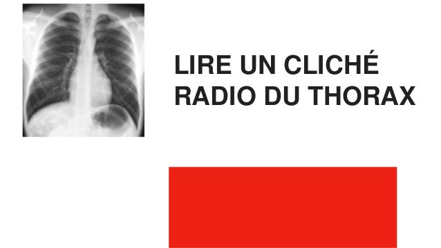 Exercice Radio Thorax