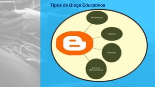 Tipos de Blogs Educativos
 
