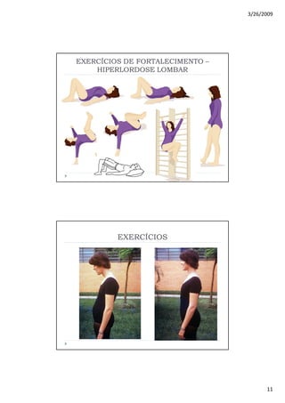 3/26/2009
11
EXERCÍCIOS DE FORTALECIMENTOEXERCÍCIOS DE FORTALECIMENTO ––
HIPERLORDOSE LOMBARHIPERLORDOSE LOMBAR
EXERCÍCIOS
 