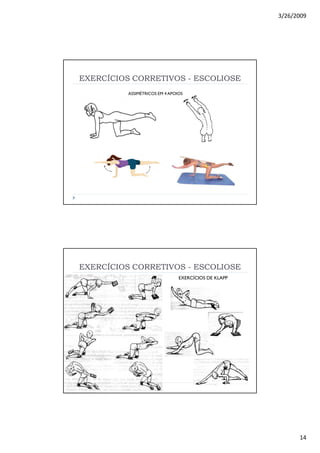 3/26/2009
14
EXERCÍCIOS CORRETIVOSEXERCÍCIOS CORRETIVOS -- ESCOLIOSEESCOLIOSE
ASSIMÉTRICOS EM 4 APOIOS
EXERCÍCIOS CORRETIVOSEXERCÍCIOS CORRETIVOS -- ESCOLIOSEESCOLIOSE
EXERCÍCIOS DE KLAPP
 