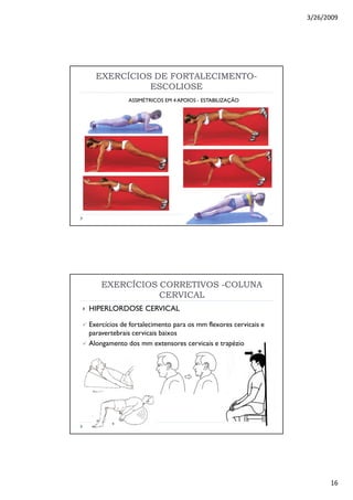 3/26/2009
16
EXERCÍCIOS DE FORTALECIMENTOEXERCÍCIOS DE FORTALECIMENTO--
ESCOLIOSEESCOLIOSE
ASSIMÉTRICOS EM 4 APOIOS - ESTABILIZAÇÃO
EXERCÍCIOS CORRETIVOSEXERCÍCIOS CORRETIVOS --COLUNACOLUNA
CERVICALCERVICAL
HIPERLORDOSE CERVICAL
Exercícios de fortalecimento para os mm flexores cervicais e
paravertebrais cervicais baixos
Alongamento dos mm extensores cervicais e trapézio
 
