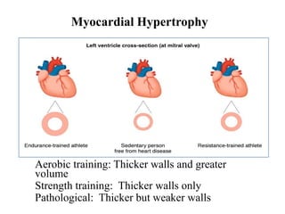 Myocardial Hypertrophy
Aerobic training: Thicker walls and greater
volume
Strength training: Thicker walls only
Pathological: Thicker but weaker walls
 