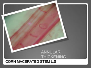 ANNULAR
                THICKENING
CORN MACERATED STEM L.S
 