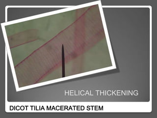 HELICAL THICKENING

DICOT TILIA MACERATED STEM
 