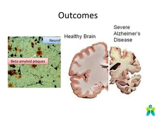 Outcomes
Beta-amyloid plaquesBeta-amyloid plaques
Neurofibrilary TanglesNeurofibrilary Tangles
 