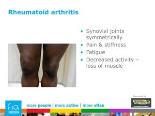 Coronary artery diseaseNational Exercise Referral Scheme in Wales (2010)Increased levels of physical activity at 12 monthsPositive effects on depression and anxietyCost effectiveSponsored by: 