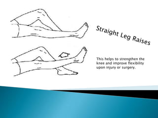 Straight Leg Raises This helps to strengthen the knee and improve flexibility upon injury or surgery.  