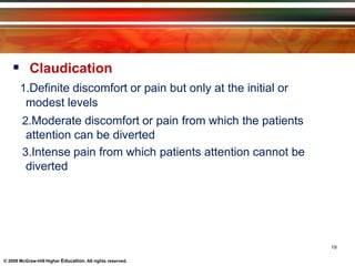  Claudication
1.Definite discomfort or pain but only at the initial or
modest levels
2.Moderate discomfort or pain from which the patients
attention can be diverted
3.Intense pain from which patients attention cannot be
diverted
19
© 2009 McGraw-Hill Higher Education. All rights reserved.
 