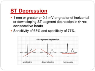 ST Depression
 1 mm or greater or 0.1 mV or greater of horizontal
or downsloping ST-segment depression in three
consecutive beats
 Sensitivity of 68% and specificity of 77%.
 