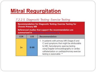 Mitral Regurgitation
 