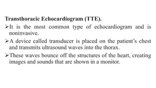 Tte Monitoring exercise testing and echocardiography.pptx