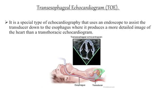Toe Heart exercise testing and echocardiography.pptx