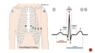 exercise tolerance test pptx