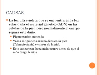 CAUSAS


La luz ultravioleta que se encuentra en la luz
solar daña el material genetico (ADN) en las
celulas de la piel ,pero normalmente el cuerpo
repara este daño.
 Pigmentación

moteada
 Vasos sanguineos aracnoideos en la piel
(Telangiectasis) y cancer de la piel.
 Este cancer con frecuencia ocurre antes de que el
niño tenga 5 años.

 