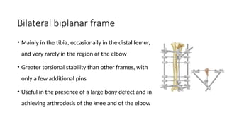 ROLE OF EXTERNAL FIXATOR IN OPEN FRACTURE.pptx