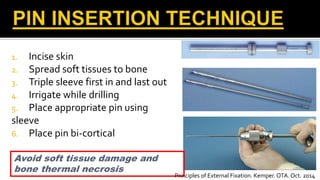 1. Incise skin
2. Spread soft tissues to bone
3. Triple sleeve first in and last out
4. Irrigate while drilling
5. Place appropriate pin using
sleeve
6. Place pin bi-cortical
Avoid soft tissue damage and
bone thermal necrosis
Principles of External Fixation. Kemper. OTA. Oct. 2014
 