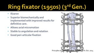  Ilizarov
 Superior biomechanically and
implemented with improved results for
definitive care.
 Allows axial micromotion
 Stable to angulation and rotation
 Good peri-articular fixation
Principles of External Fixation. Kemper. OTA. Oct. 2014
 