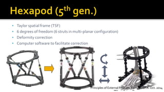  Taylor spatial frame (TSF)
 6 degrees of freedom (6 struts in multi-planar configuration)
 Deformity correction
 Computer software to facilitate correction
Principles of External Fixation. Kemper. OTA. Oct. 2014
 