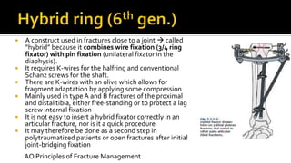 A construct used in fractures close to a joint  called
“hybrid” because it combines wire fixation (3/4 ring
fixator) with pin fixation (unilateral fixator in the
diaphysis).
 It requires K-wires for the halfring and conventional
Schanz screws for the shaft.
 There are K-wires with an olive which allows for
fragment adaptation by applying some compression
 Mainly used in typeA and B fractures of the proximal
and distal tibia, either free-standing or to protect a lag
screw internal fixation
 It is not easy to insert a hybrid fixator correctly in an
articular fracture, nor is it a quick procedure
 It may therefore be done as a second step in
polytraumatized patients or open fractures after initial
joint-bridging fixation
AO Principles of Fracture Management
 