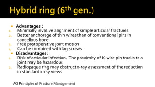  Advantages :
1. Minimally invasive alignment of simple articular fractures
2. Better anchorage of thin wires than of conventional pins in
cancellous bone
3. Free postoperative joint motion
4. Can be combined with lag screws
 Disadvantages :
1. Risk of articular infection. The proximity of K-wire pin tracks to a
joint may be hazardous
2. Radiopaque ring may obstruct x-ray assessment of the reduction
in standard x-ray views
AO Principles of Fracture Management
 