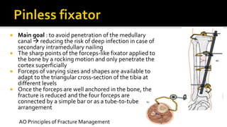  Main goal : to avoid penetration of the medullary
canal  reducing the risk of deep infection in case of
secondary intramedullary nailing
 The sharp points of the forceps-like fixator applied to
the bone by a rocking motion and only penetrate the
cortex superficially
 Forceps of varying sizes and shapes are available to
adapt to the triangular cross-section of the tibia at
different levels
 Once the forceps are well anchored in the bone, the
fracture is reduced and the four forceps are
connected by a simple bar or as a tube-to-tube
arrangement
AO Principles of Fracture Management
 
