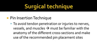  Pin InsertionTechnique
 To avoid tendon penetration or injuries to nerves,
vessels, and muscles  must be familiar with the
anatomy of the different cross-sections and make
use of the recommended pin placement sites
 