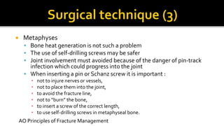  Metaphyses
 Bone heat generation is not such a problem
 The use of self-drilling screws may be safer
 Joint involvement must avoided because of the danger of pin-track
infection which could progress into the joint
 When inserting a pin or Schanz screw it is important :
▪ not to injure nerves or vessels,
▪ not to place them into the joint,
▪ to avoid the fracture line,
▪ not to “burn” the bone,
▪ to insert a screw of the correct length,
▪ to use self-drilling screws in metaphyseal bone.
AO Principles of Fracture Management
 