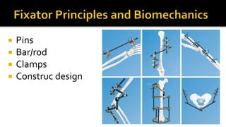  Pins
 Bar/rod
 Clamps
 Construc design
 