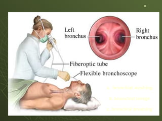 a. bronchial washing
b. bronchial lavage
c. bronchial brushing
 