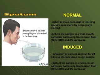NORMAL
-obtain at three consecutive morning
sputum specimens by deep cough
method.
-Collect the sample in a wide-mouth
container containing Saccomano fluid
(50% EtOH and 2% carbowax)
INDUCED
- Inhalation of aerosol solution for 20
mins to produce deep cough sample.
- Collect the sample in a wide-mouth
container containing Saccomano fluid
(50% EtOH and 2% carbowax)
 